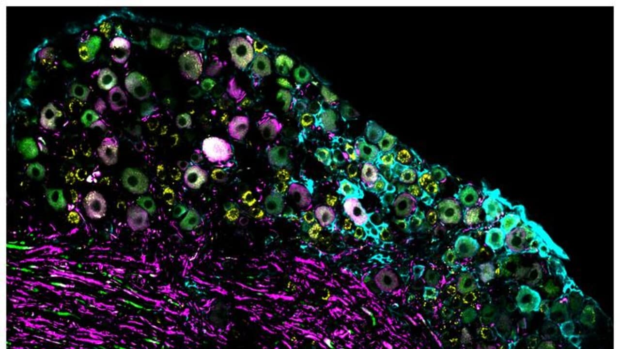 El descubrimiento abre ideas para la investigación sobre el dolor y los trastornos sensoriales